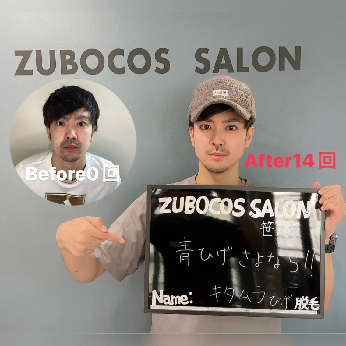 メンズ パーソナルセルフ脱毛 ズボコスサロンのエステ・リラクイメージ