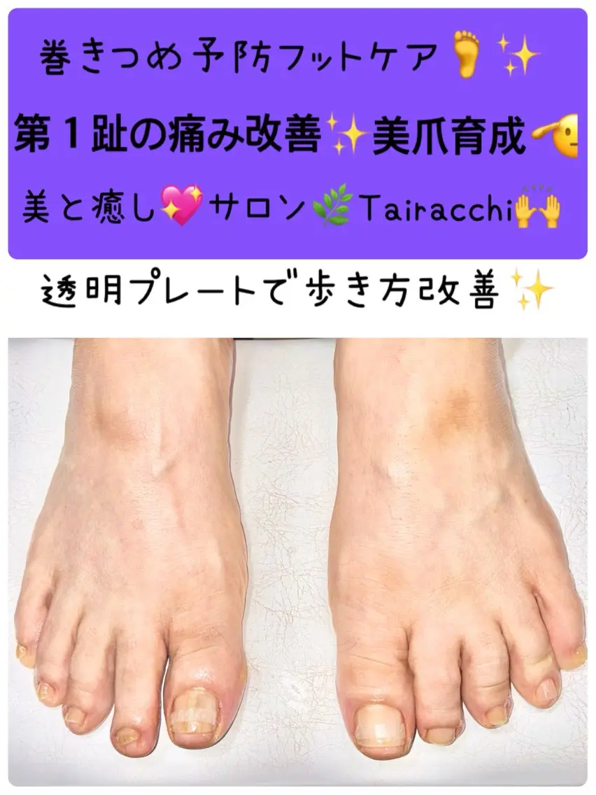 ネイル フットネイル Tairacchi タイラッチのエステ・リラクイメージ