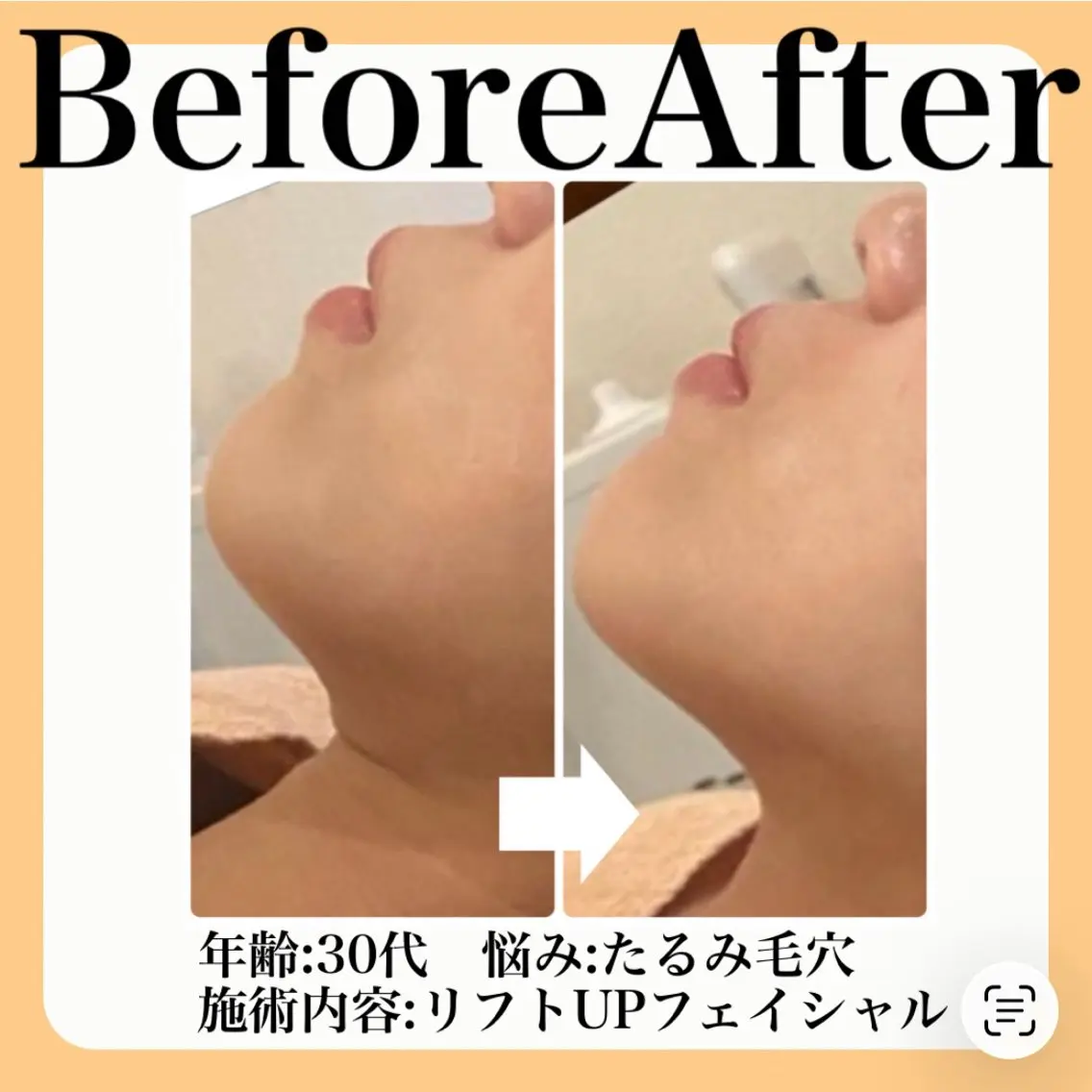 肌質改善 suiのエステ・リラクイメージ