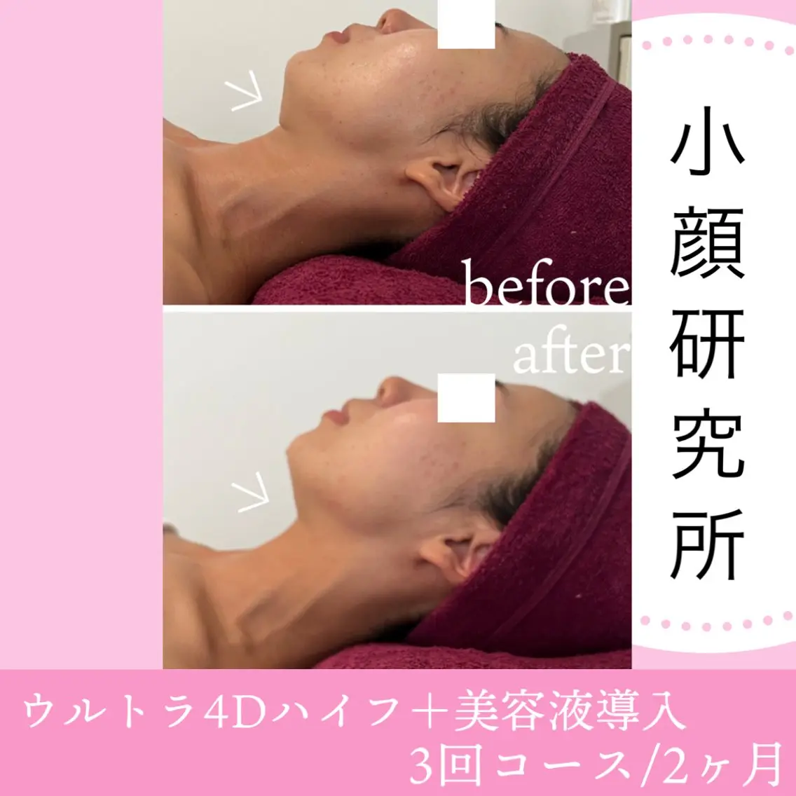 beauty salon  epのエステ・リラクイメージ