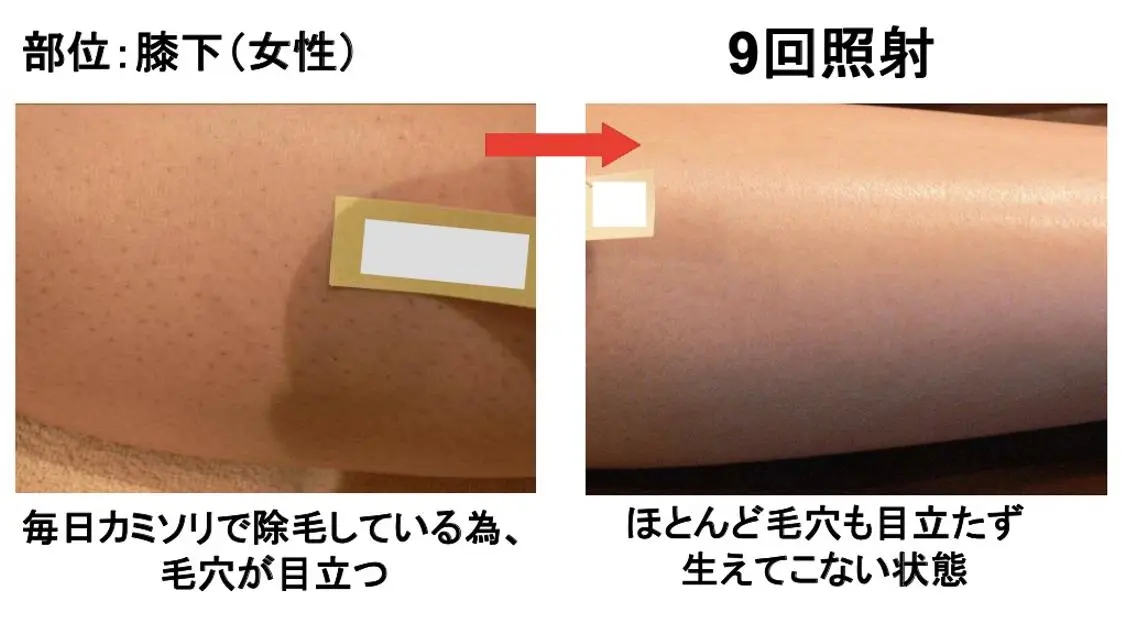 leolo武蔵浦和 肌質改善&脱毛のエステ・リラクイメージ