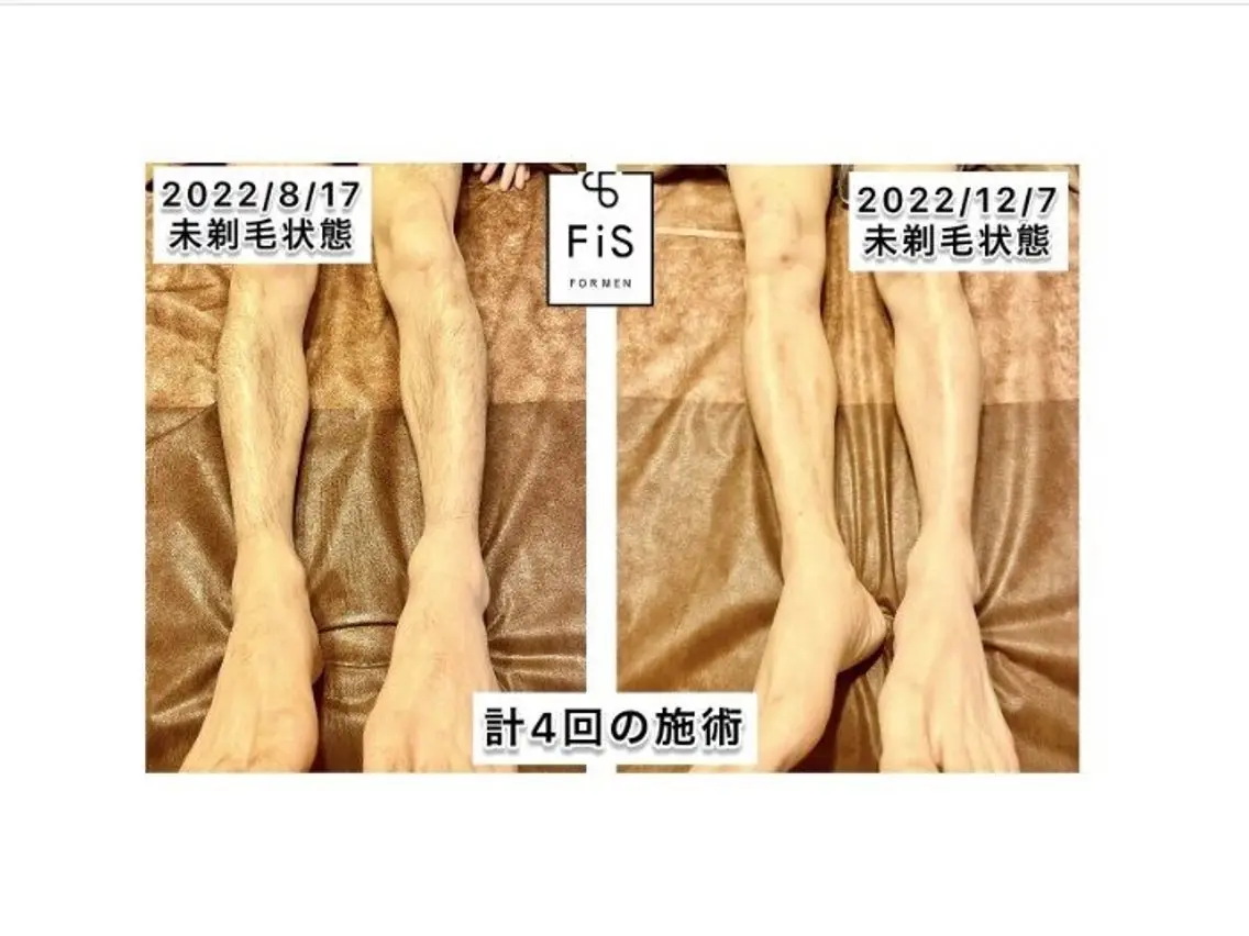脱毛 西内 【FIS】のエステ・リラクイメージ