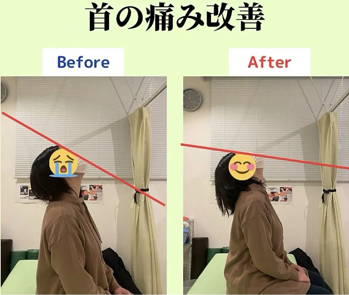 【初回】肩こり・首こり集中整体!ガンコな首肩こりが気になる方におすすめ!の写真