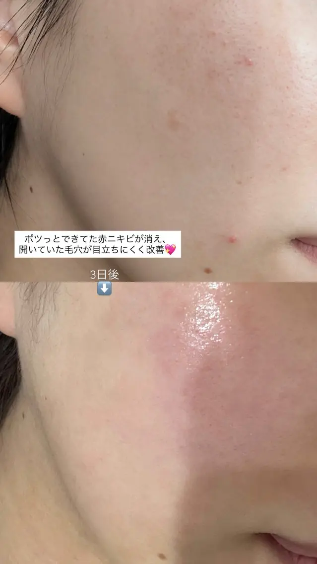 マツエク・マツパ エステ 愛維美水光美肌専門店 メンズレディースokのエステ・リラクイメージ