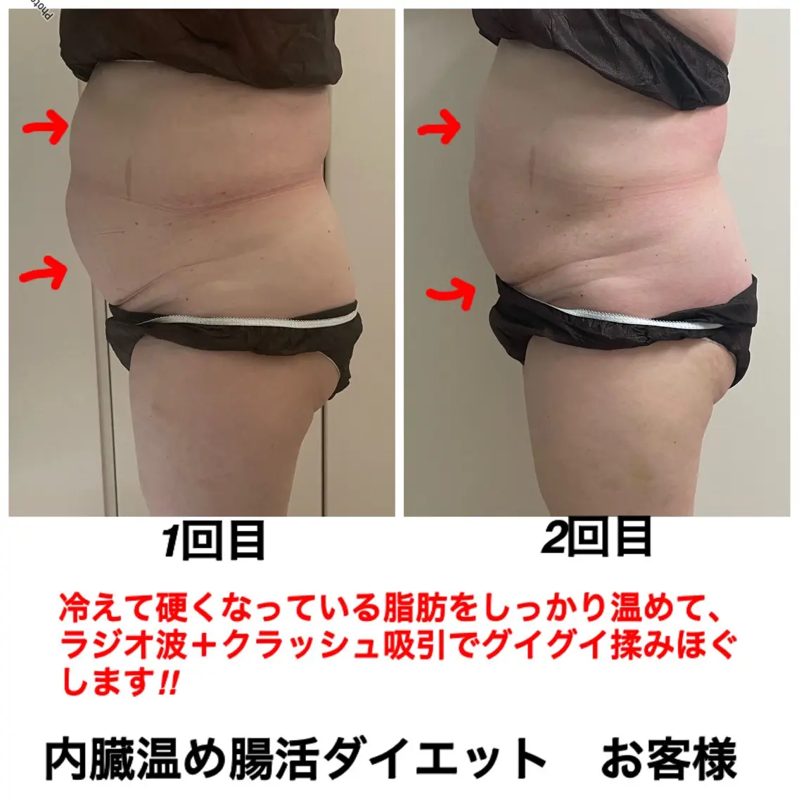 エステ ネイル・エステサロン UILANIのエステ・リラクイメージ