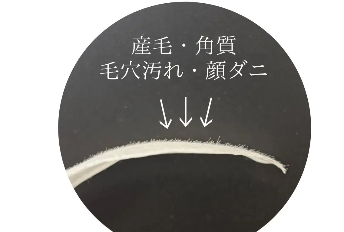 脱毛 emirai 🌙AYANOのエステ・リラクイメージ