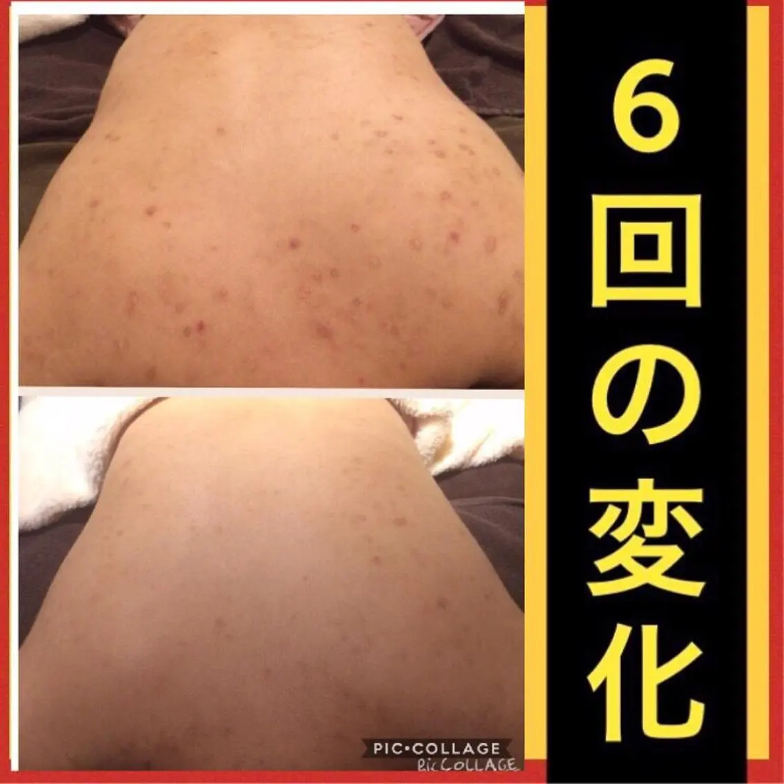 ミディアム パーマ ヘアアレンジ メンズ キッズ ネイル マツエク・マツパ エステ リラク ニキビ・肌質改善専門 ♡人生が変わるサロンのエステ・リラクイメージ