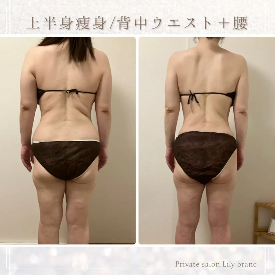 Lily branc 痩身/小顔/肌質改善のエステ・リラクイメージ