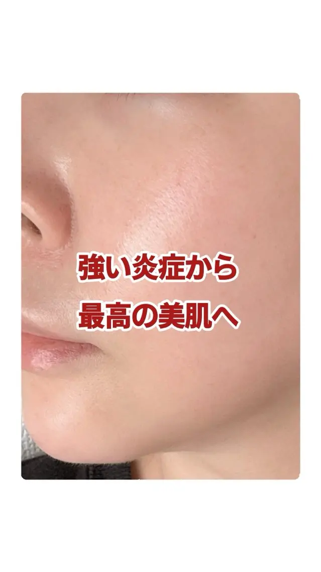 エステ リラク グリーンピール専門店 サロンY【大阪】のエステ・リラクイメージ