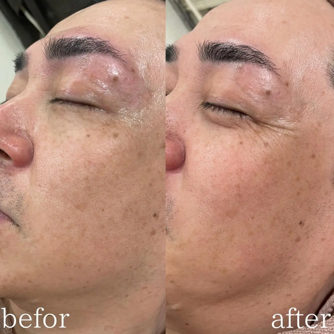 メンズ mish eyebrowのエステ・リラクイメージ