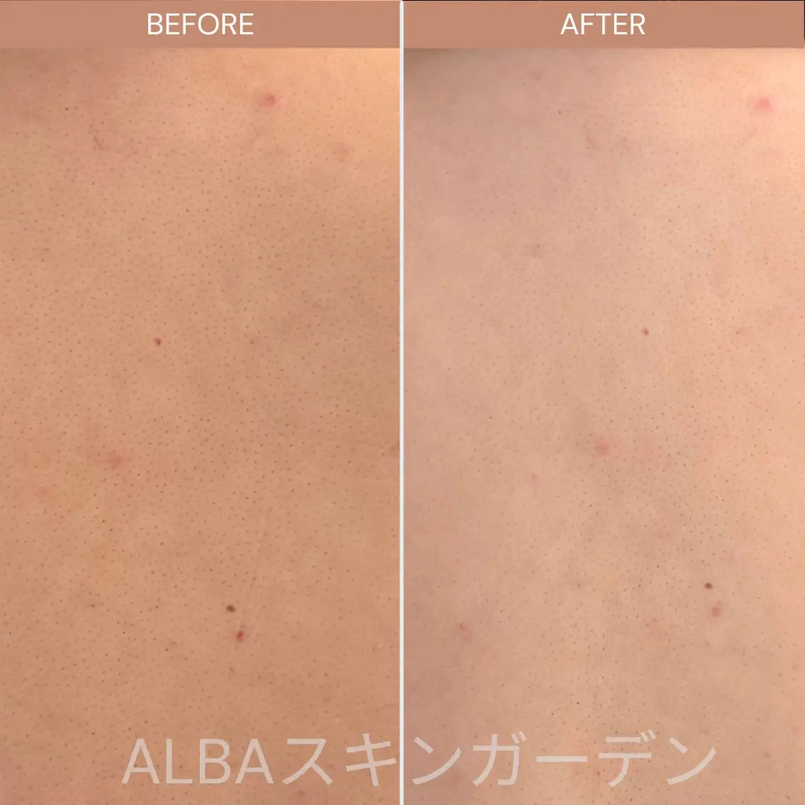 ALBA🌱 yuriのエステ・リラクイメージ