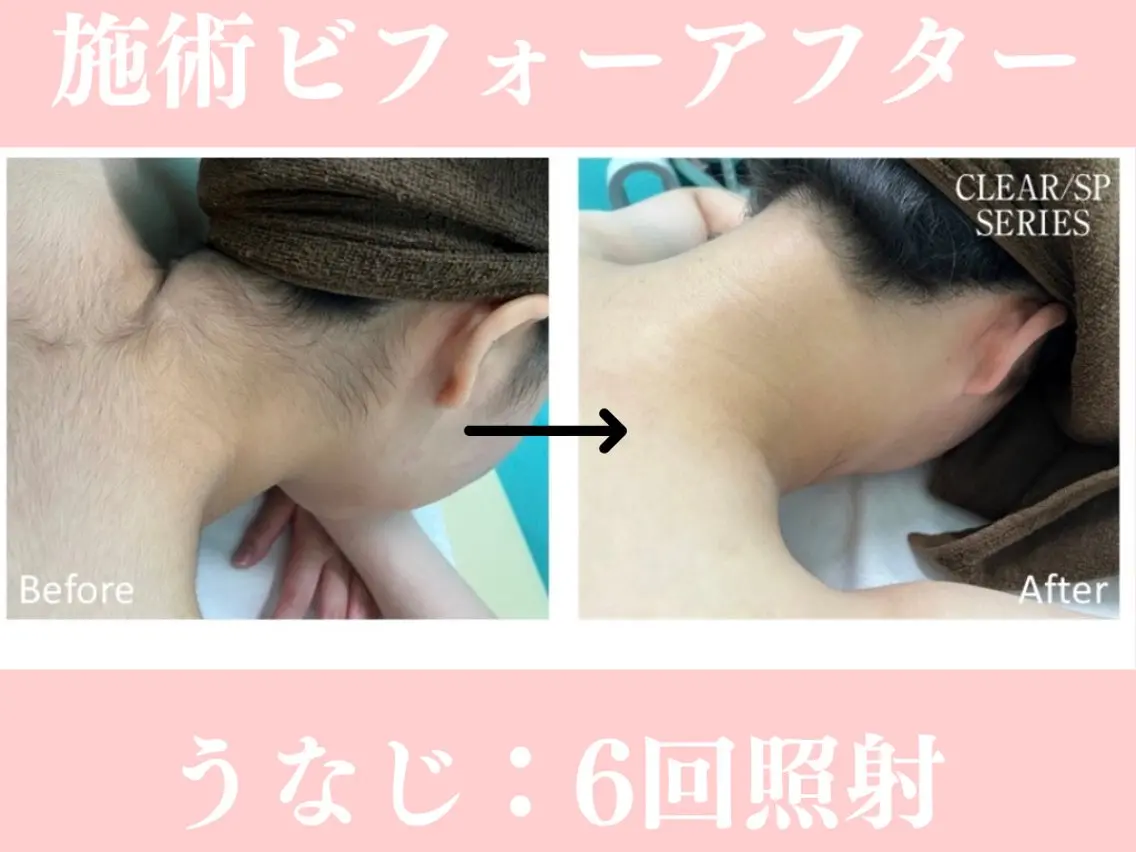 脱毛 beauty SalonRcoinのマツエク・マツパデザイン