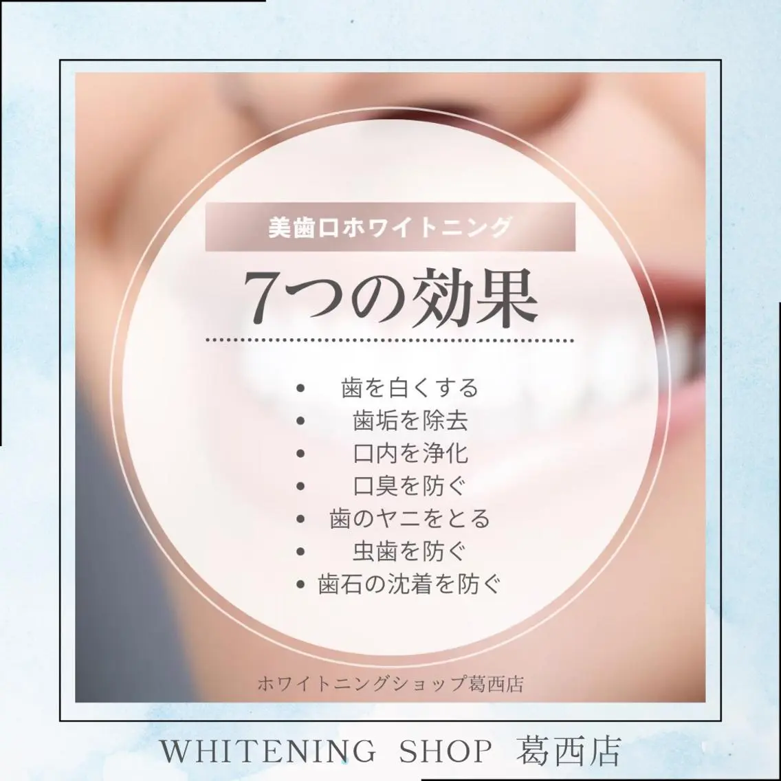 その他 ホワイトニング ショップ葛西店のその他イメージ