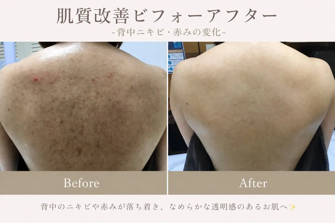 エステ ニキビ専門サロン oliss新宿店のエステ・リラクイメージ