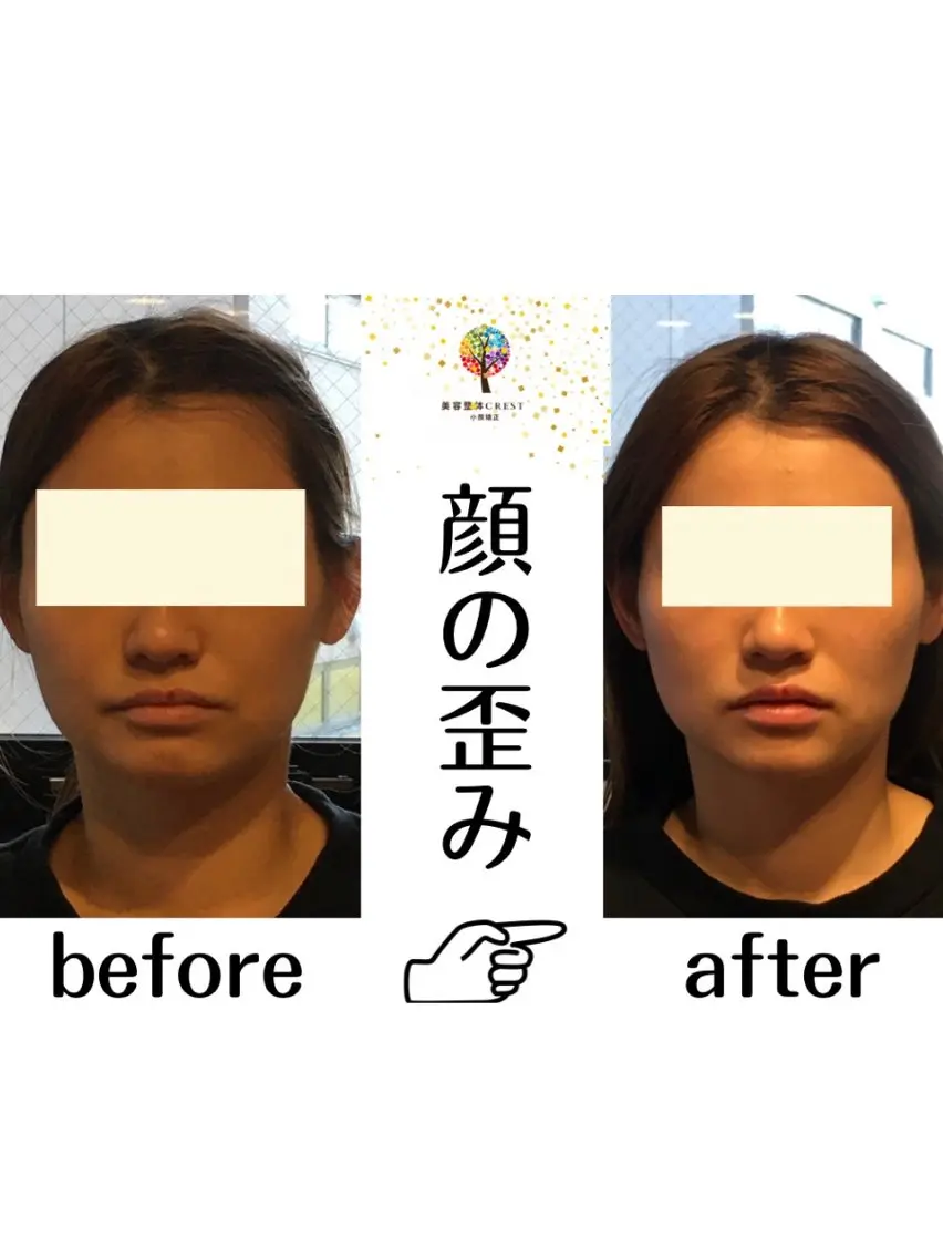 美容整体.小顔矯正 CREST佐藤大雅のエステ・リラクイメージ
