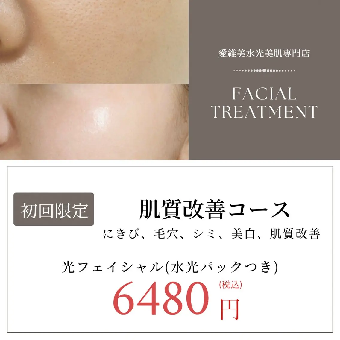 エステ 愛維美水光美肌専門店 メンズレディースokのエステ・リラクイメージ