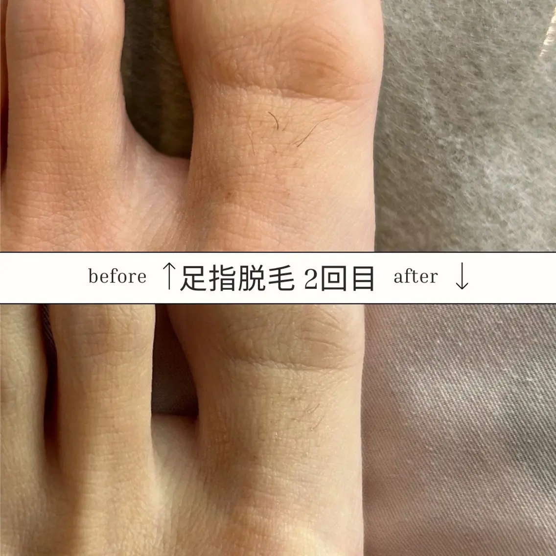 メンズ 脱毛 SKIN GYM メンズ専門脱毛サロンのエステ・リラクイメージ