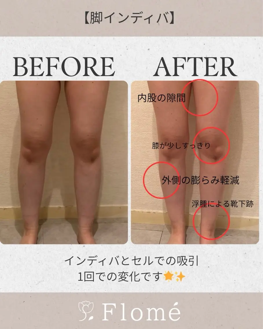山脇 はるかのエステ・リラクイメージ