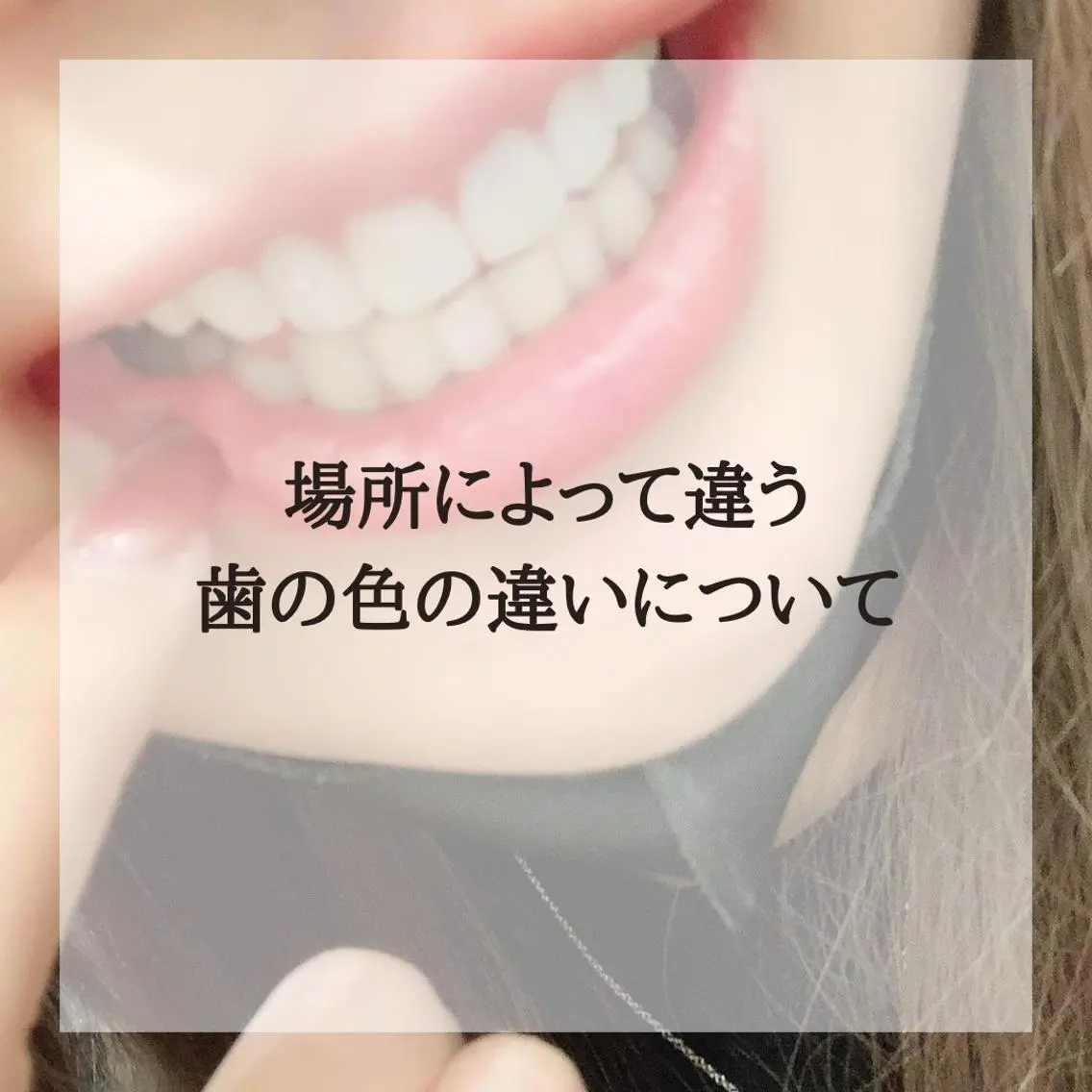 ライトビューティー 恵比寿店のその他イメージ