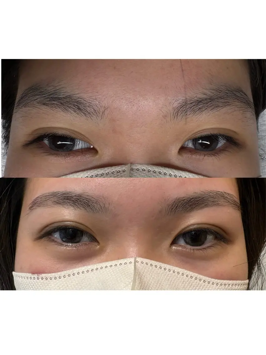 アイブロウ トータルビューティー サロン・Ｎの眉毛・アイブロウイメージ