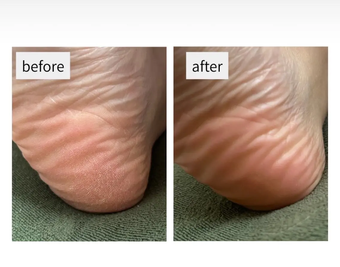 ガサガサかかと卒業!足裏つるつるフットケア60分。膝下オイルマッサージ付きの写真