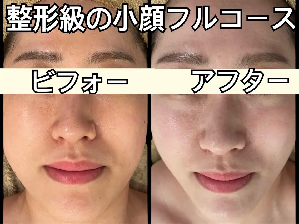 小顔と美肌サロン クリニカルサロンココのエステ・リラクイメージ