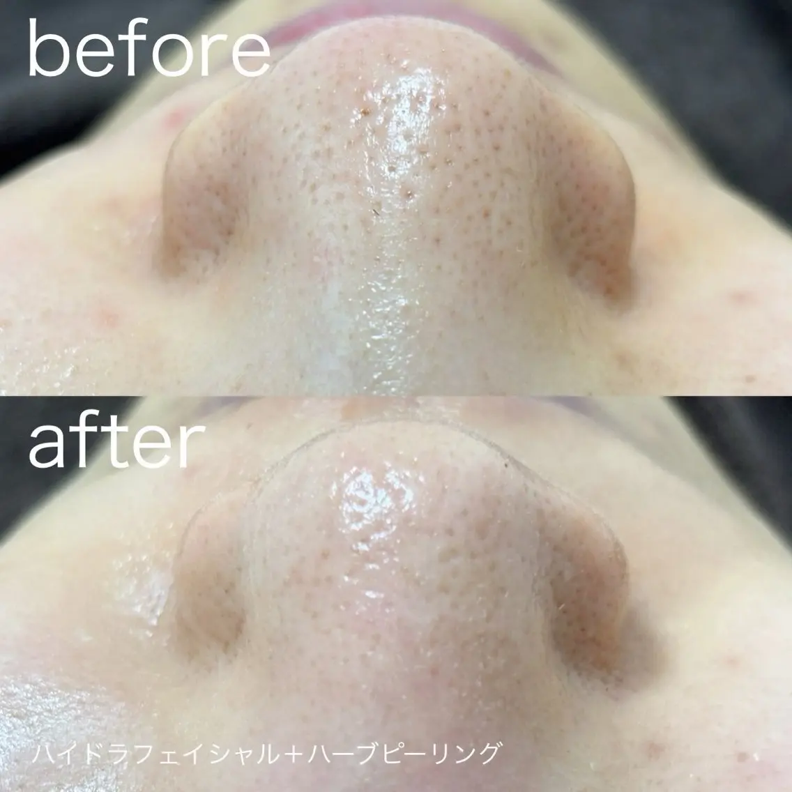 その他 lulularico Yuのネイルデザイン