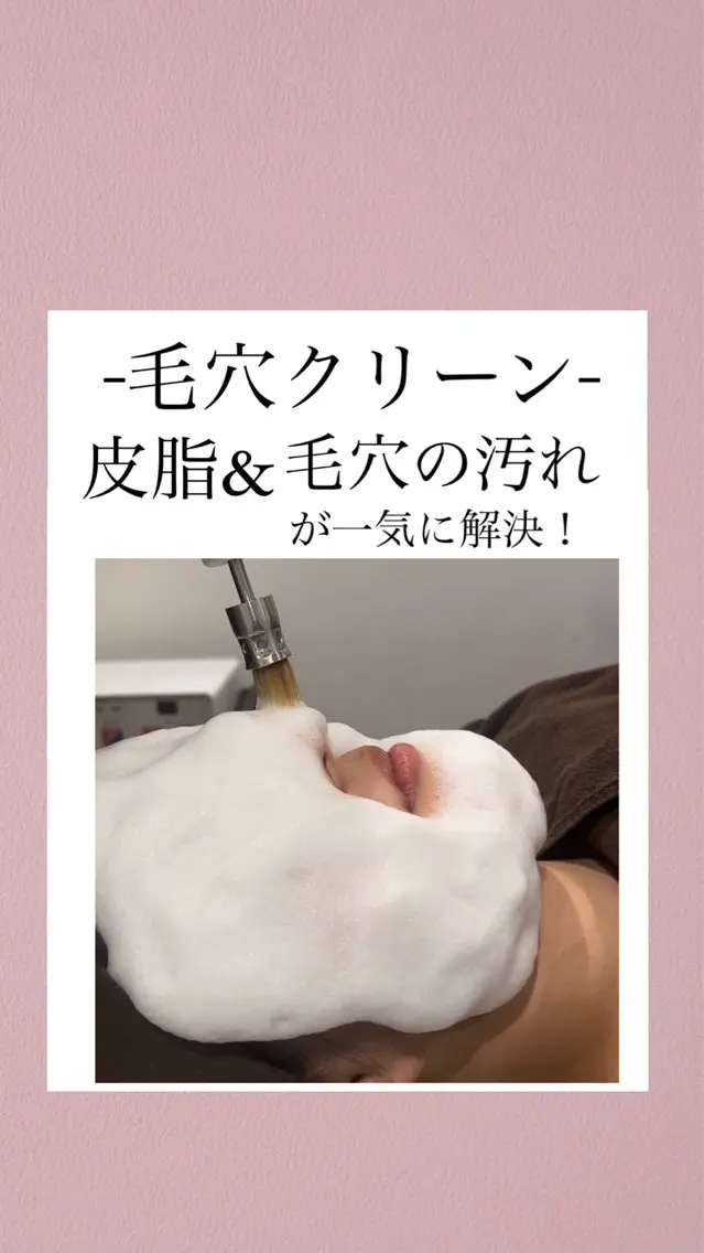 【初回限定】1番人気‼️ニキビ&皮脂&毛穴汚れが一気に解決✨毛穴リメイクプロの写真
