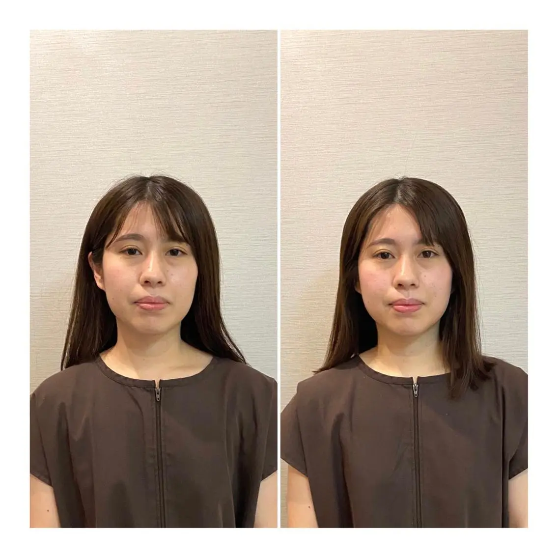 ロング その他 即小顔♥️美容鍼× ハーブピーリングのその他イメージ
