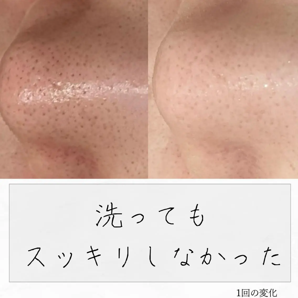 ニキビ経験者が施術 する専門サロン🌻のエステ・リラクイメージ