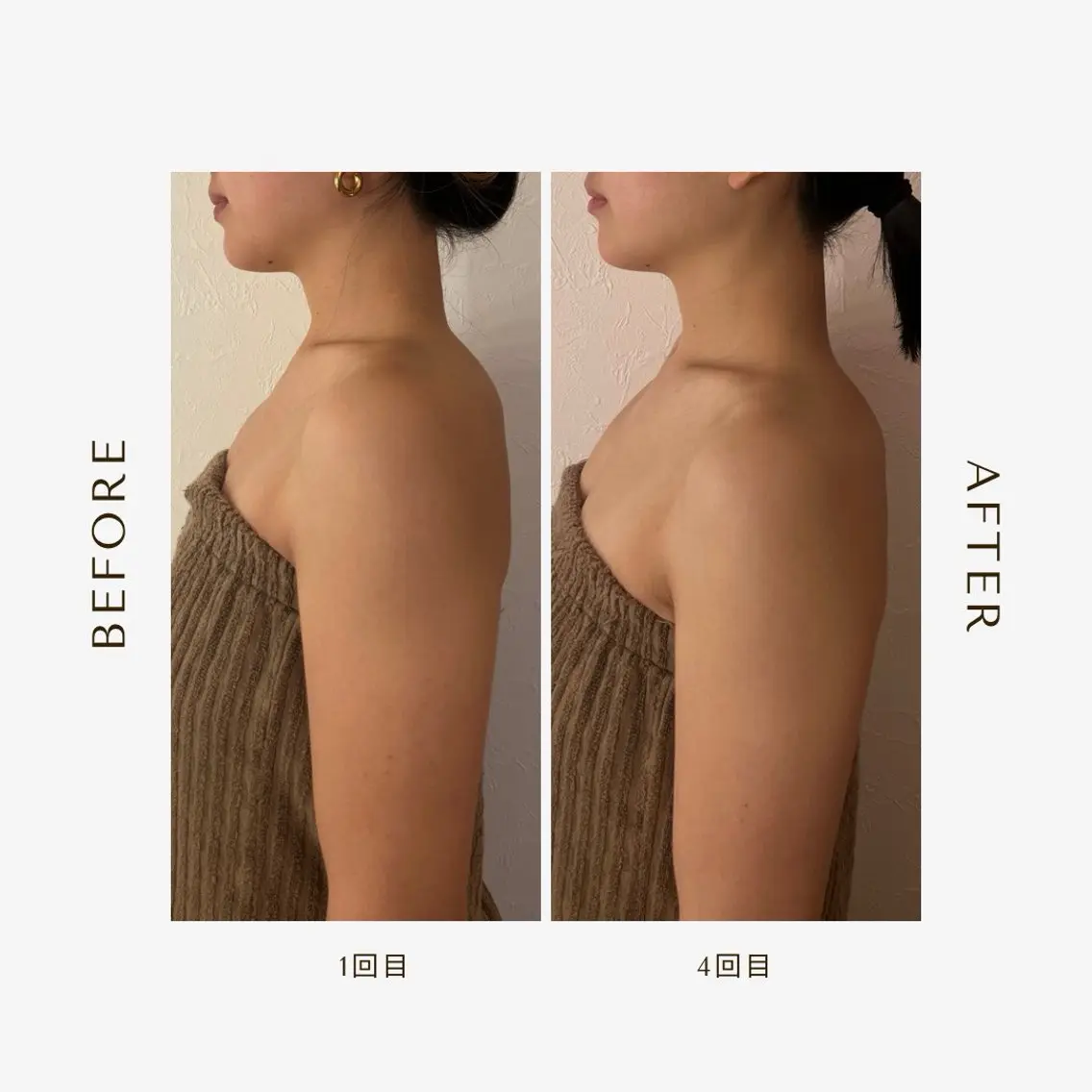 【睡眠改善】ドライヘッドスパ60分🧖🏻♀️✨の写真