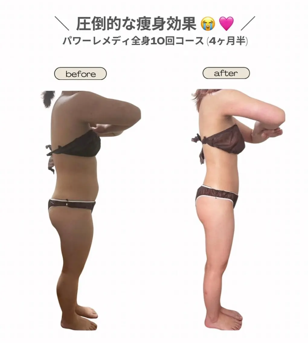 エステ リラク 《本気痩せ×疲労改善 》  BILOOPのエステ・リラクイメージ