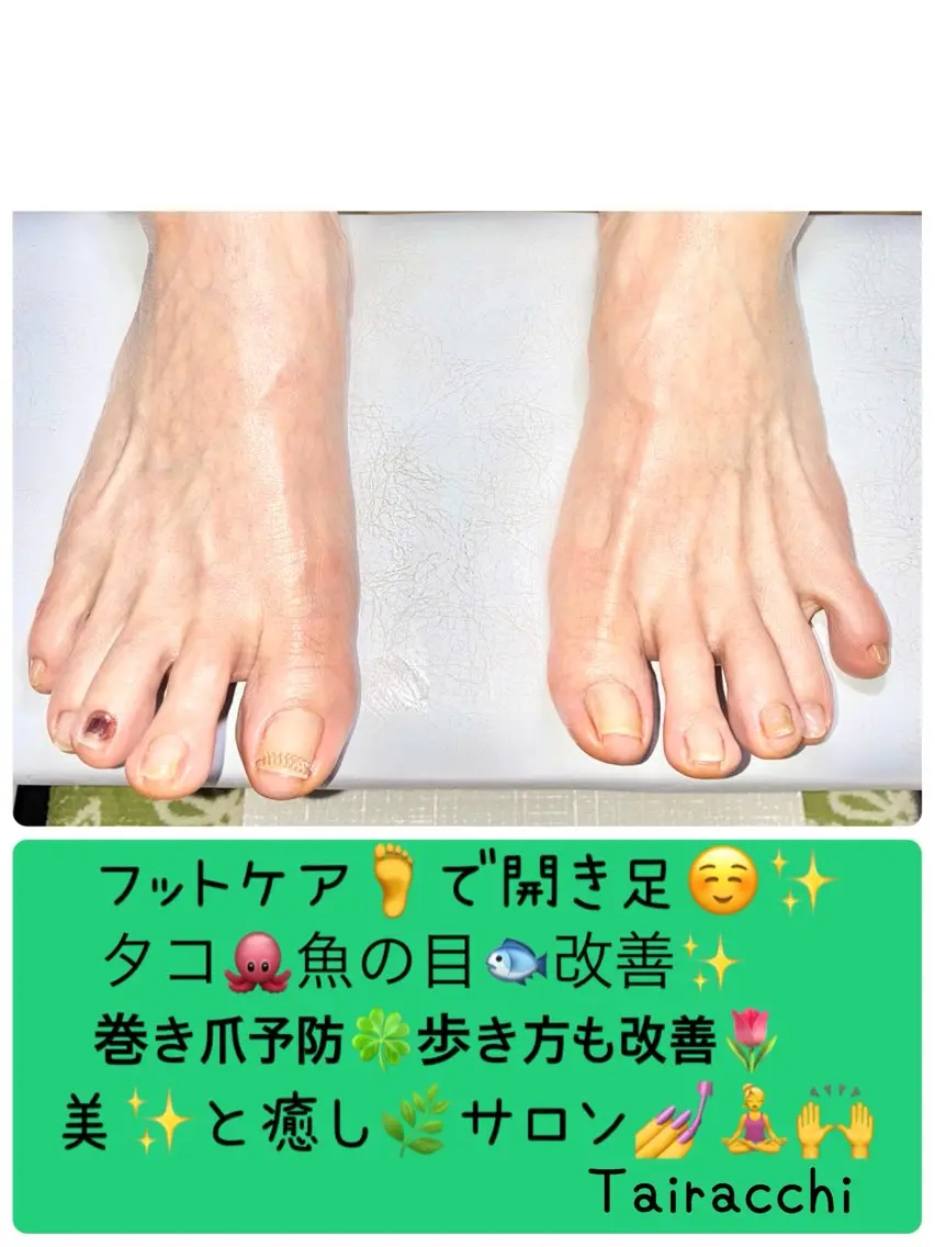 ネイル フットネイル フットネイル Tairacchi ﾀｲﾗｯﾁのエステ・リラクイメージ