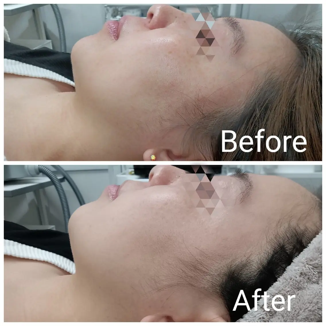 エステ 肌質改善Beauty salon Renのエステ・リラクイメージ
