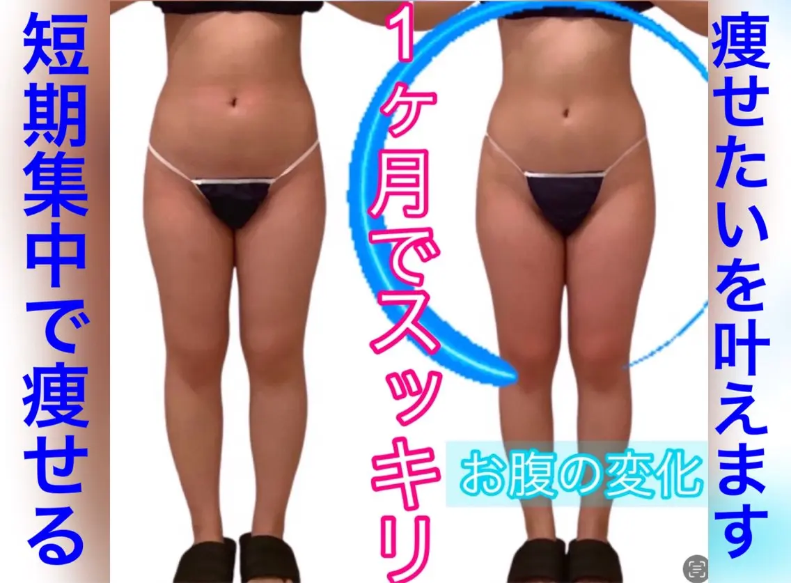 痩身ダイエット&小顔 🩷アールズスリムのエステ・リラクイメージ