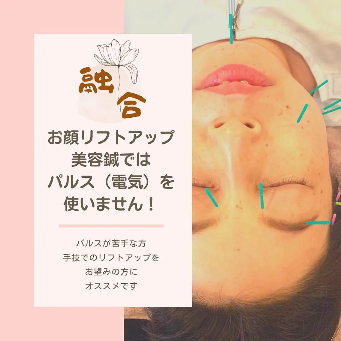 エステ リラク 美容鍼とアロマ 融合のエステ・リラクイメージ