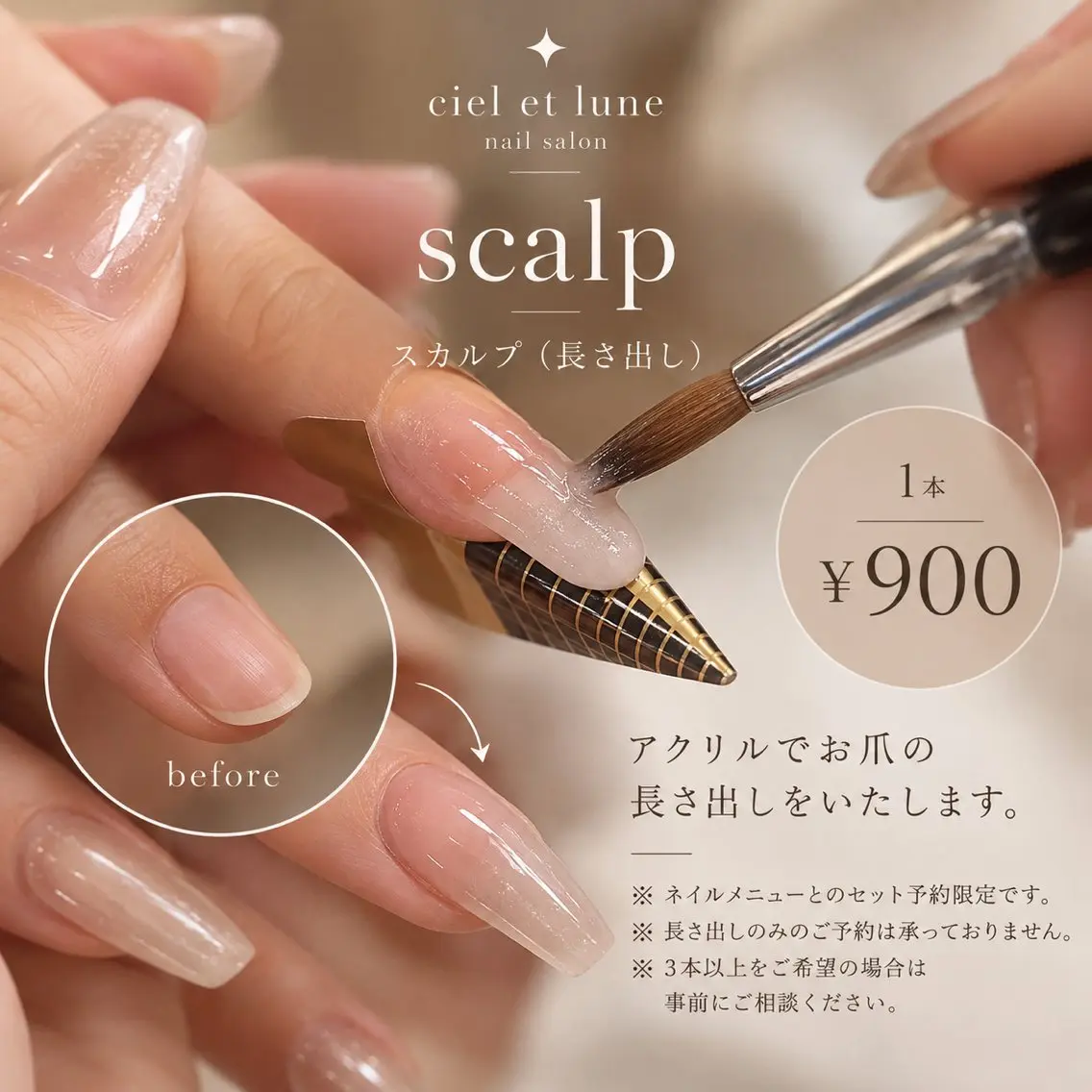 ✋🏼 【option】scalp 1本の写真