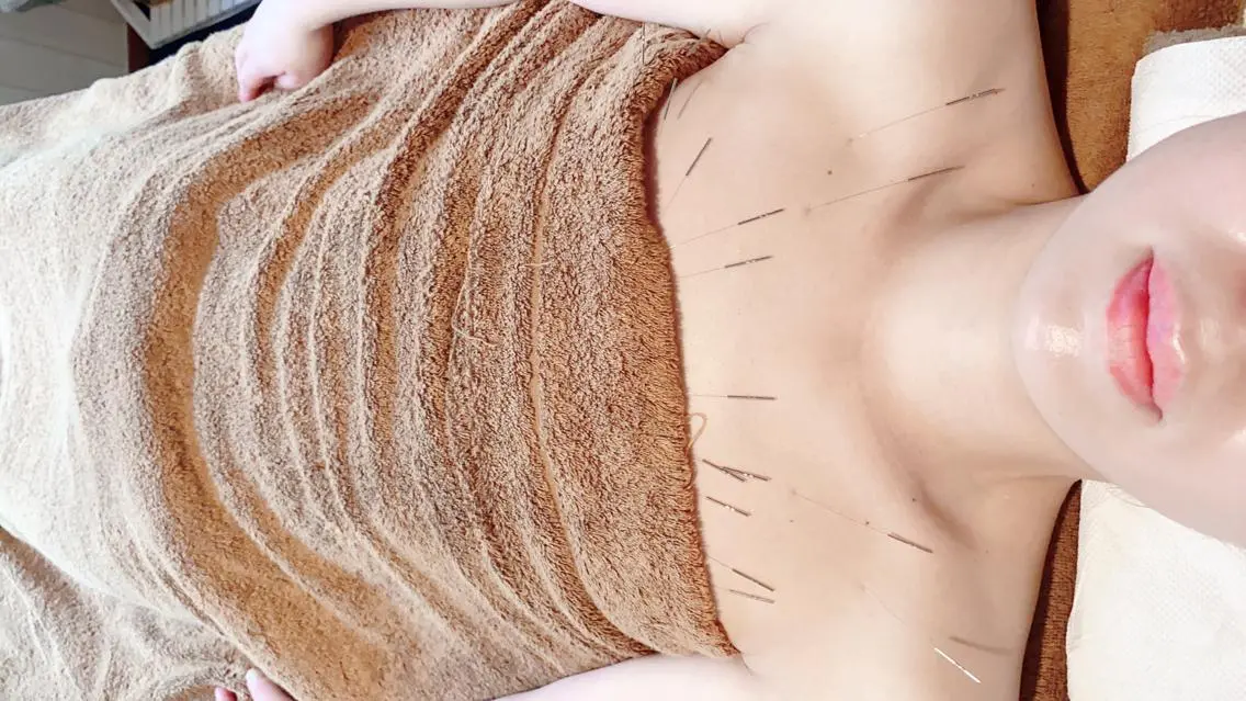 美乳鍼の写真