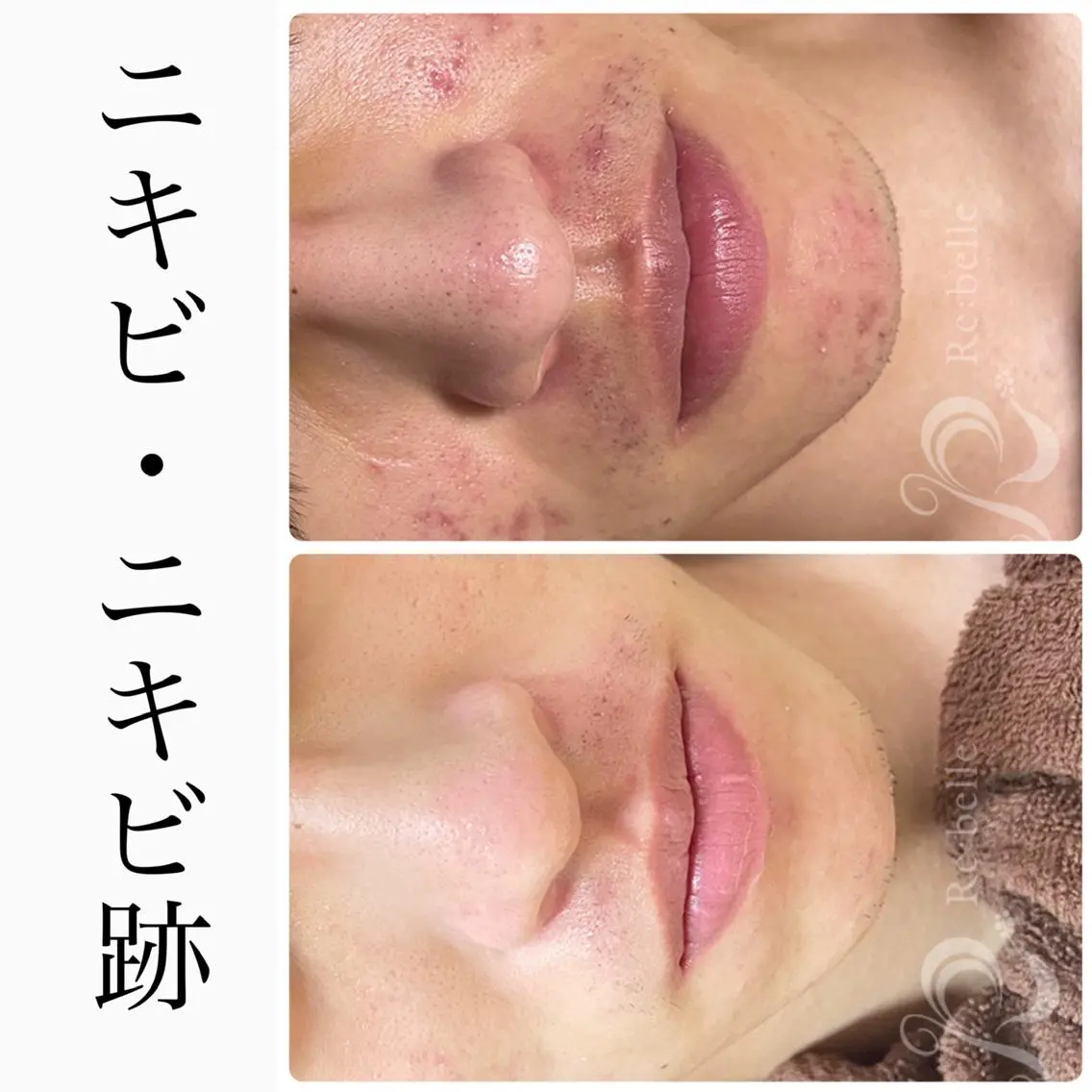 エステ ハーブピーリング専門 BIOEL横浜のエステ・リラクイメージ