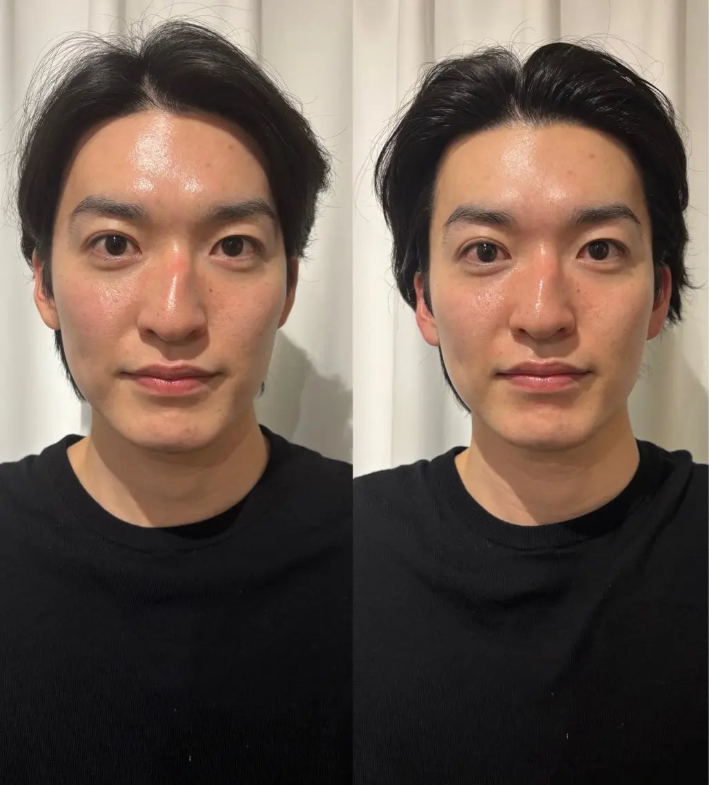 エステ リラク 美容鍼灸サロン mahoroba院長のエステ・リラクイメージ