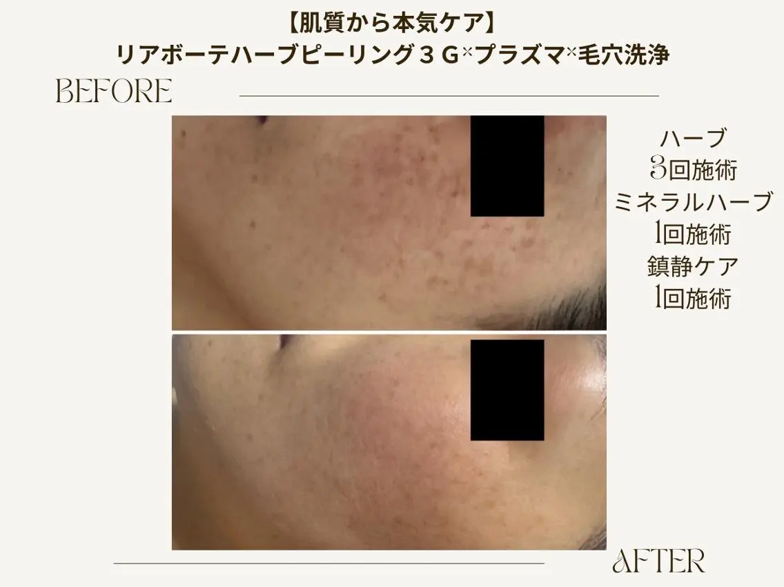 エステ ReCell 肌管理のエステ・リラクイメージ