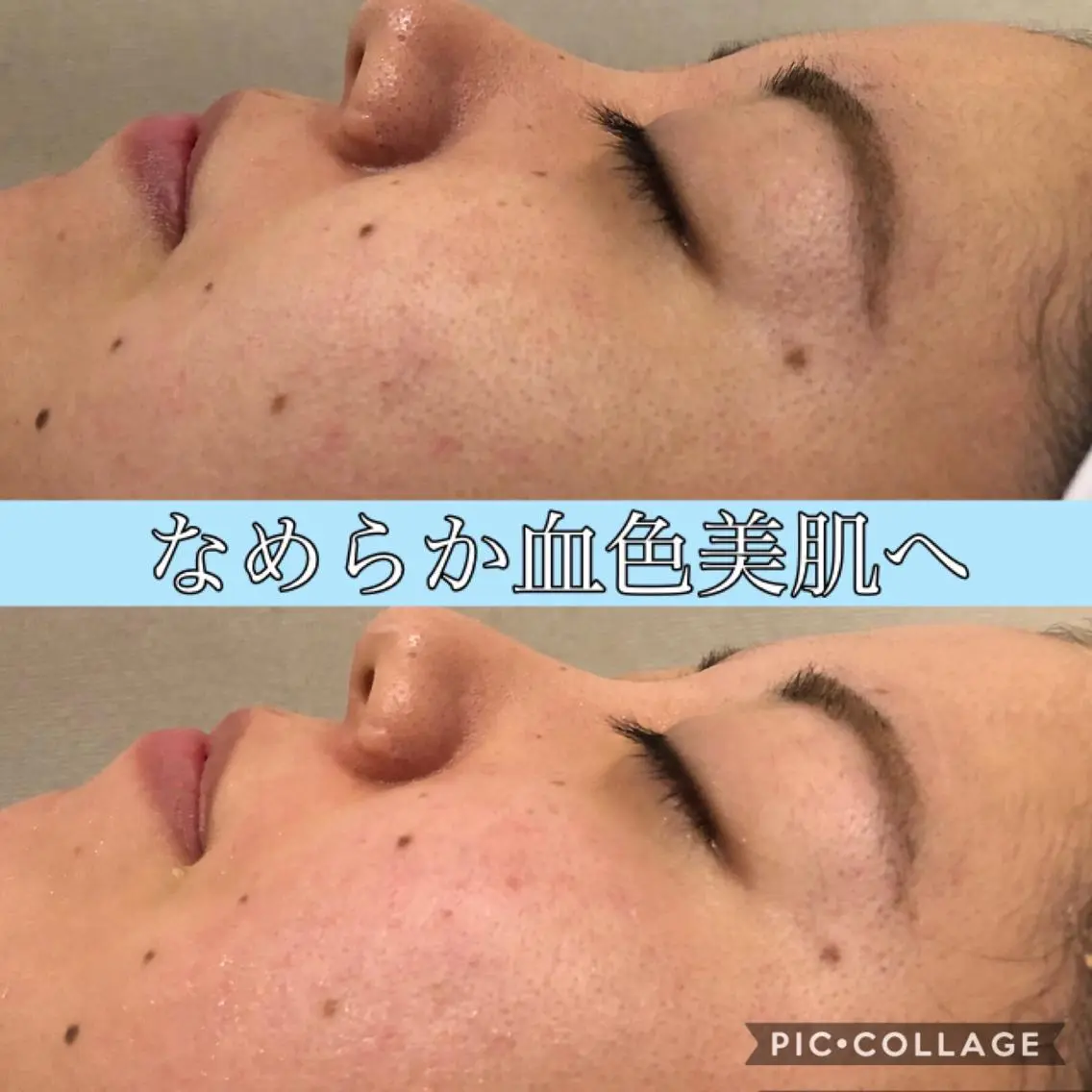 ミディアム カラー パーマ ヘアアレンジ キッズ ネイル マツエク・マツパ エステ リラク EnsorClair 代表 野口真央のエステ・リラクイメージ