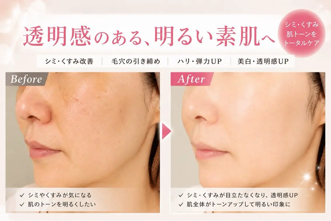 【シミ・毛穴・くすみケア】フォト光×美容液導入の写真
