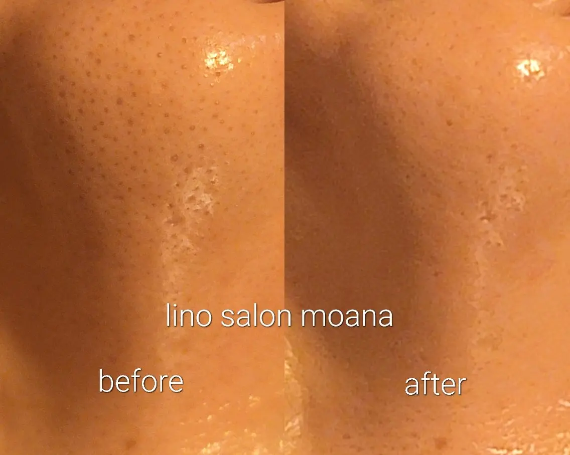 lino salon  moanaのエステ・リラクイメージ