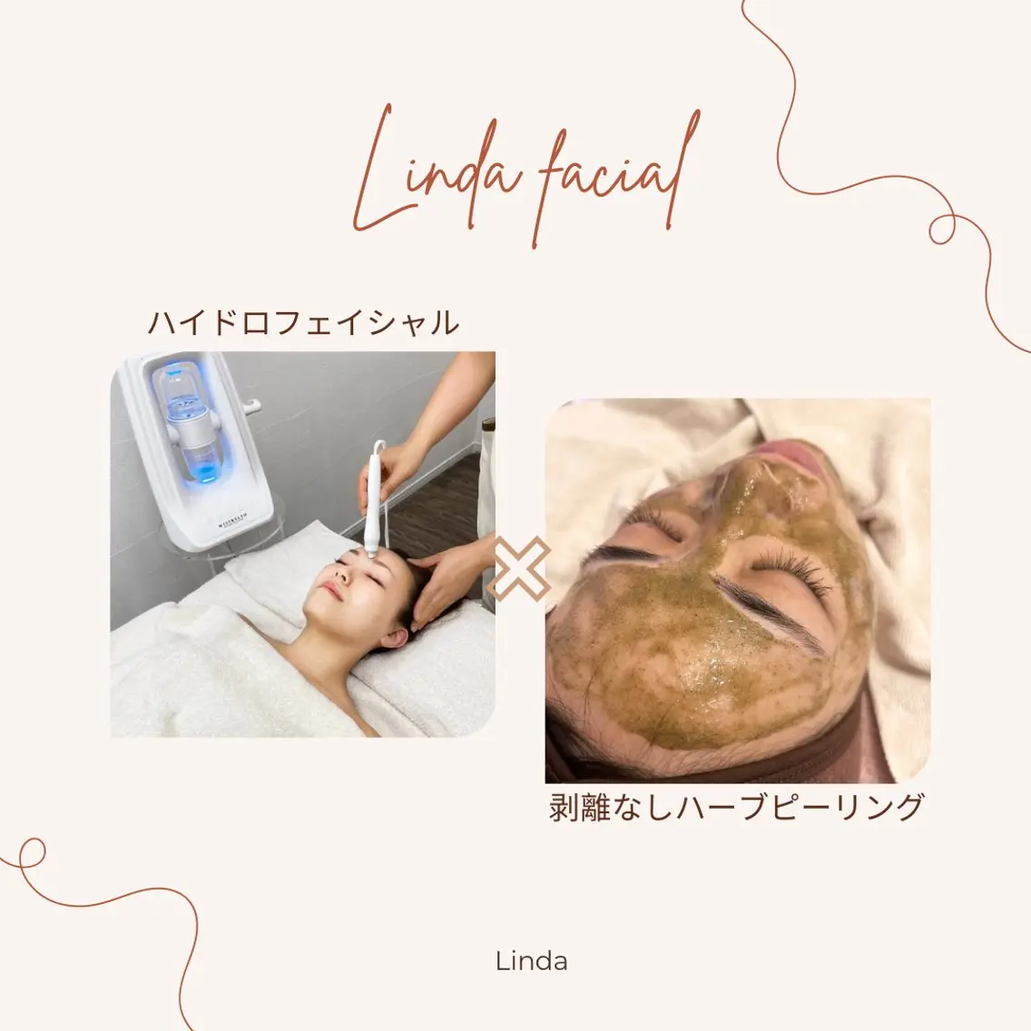 エステ 小顔&毛穴・肌質改善 LINDA西宮 AIのエステ・リラクイメージ