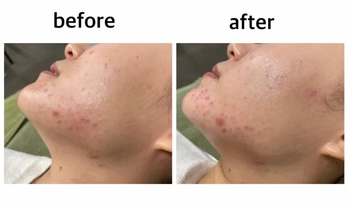 ビューティーサロン B.glossyのネイルデザイン