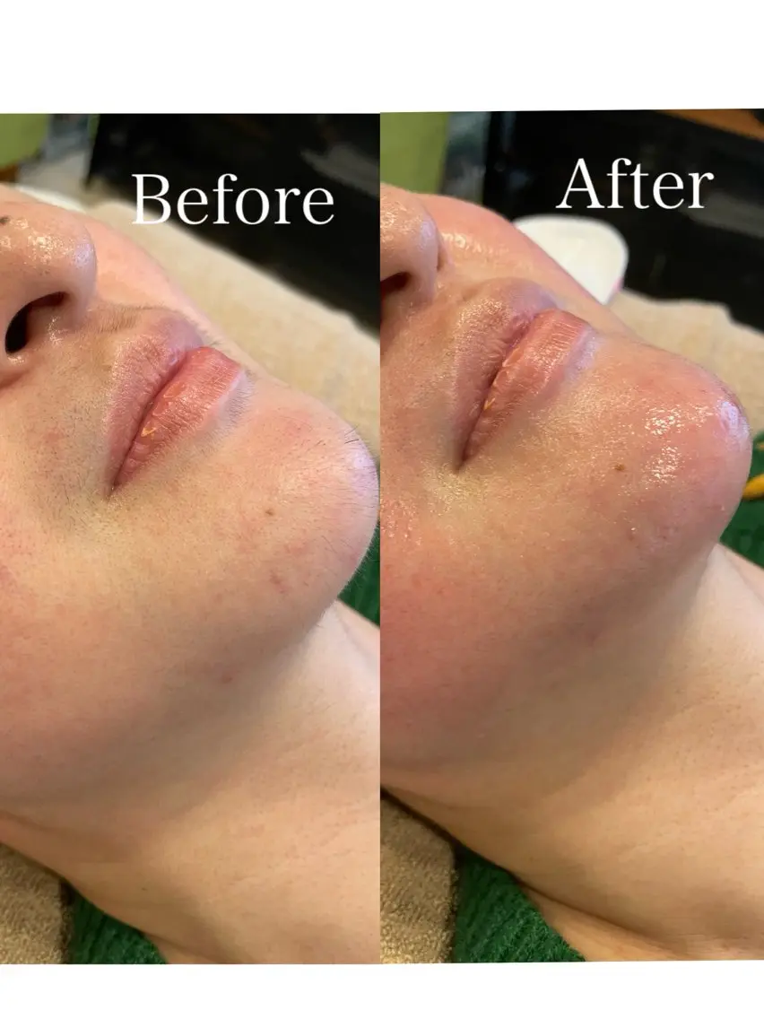 en.  eye& facewaxのエステ・リラクイメージ