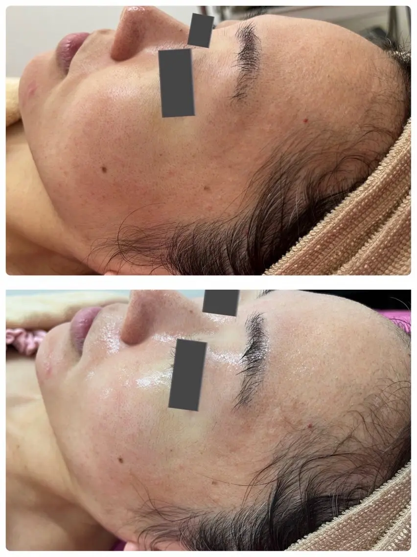 40代からのお悩みエステ🇰🇷の写真