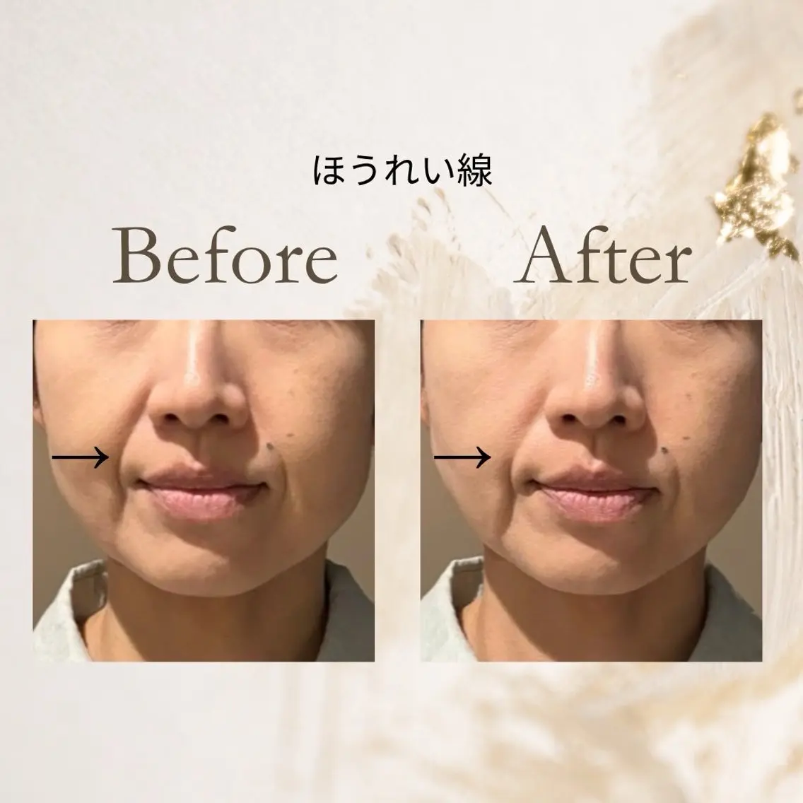 健康×美容鍼鍼灸院 あさば整体院三ノ輪店のエステ・リラクイメージ
