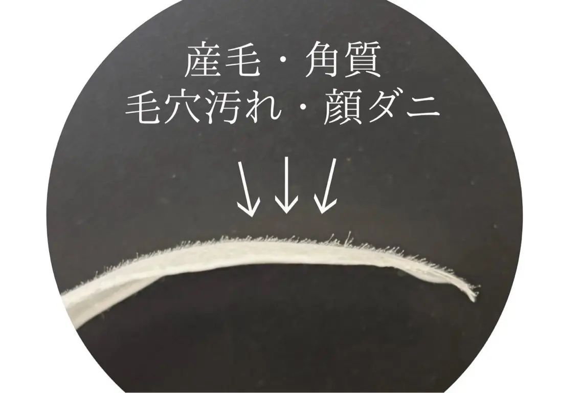脱毛 emirai🌱 AYUMIのエステ・リラクイメージ